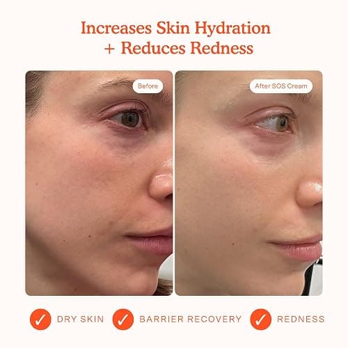 Tower 28 Beauty SOS Daily Skin Barrier Redness Recovery Moisturizer 1.86 oz / 52.73 g thumbnail 2