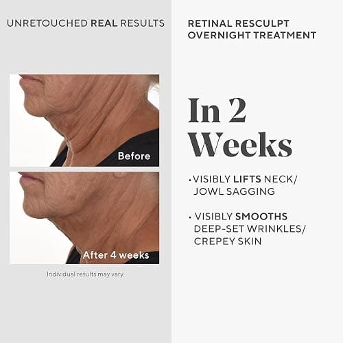 Murad Retinal ReSculpt Overnight Treatment - Resurgence Anti-Aging Serum for Lines and Wrinkles – Encapsulated Vitamin A Skin Care for Smoothing, Firming and Lifting Face and Neck - 1 Fl Oz (Pack of 1) thumbnail 3