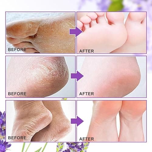 ALIVER Foot Peel Mask 3 Pack, Exfoliator Peel Off Calluses Dead Skin Callus Remover, Baby Soft Smooth Touch Feet-Men Women (Lavender) thumbnail 5