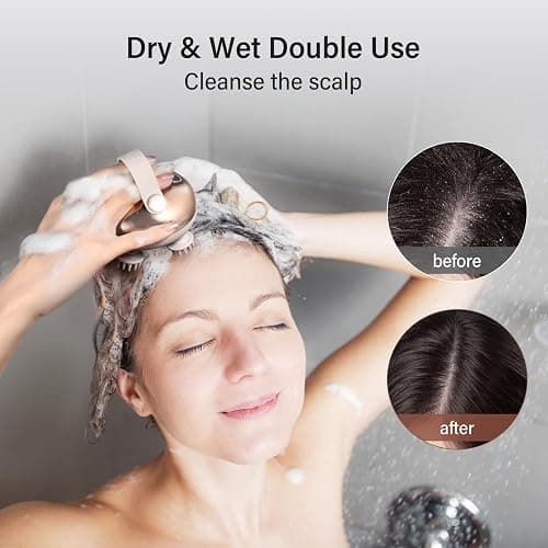 arboleaf Scalp Massager Kneading Head Massager Scalp Stress Relax Portable Rechargeable Hair Massager Shower Massage Waterproof Cat Massager Scratcher,Gift for Mom Dad thumbnail 4