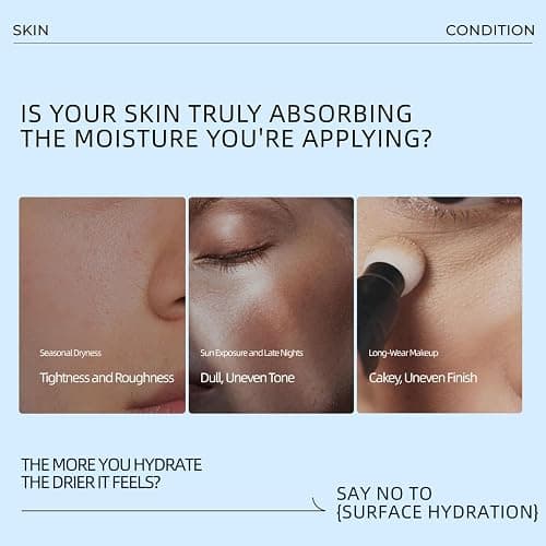 YILIAN Face Mist Natural Facial Spray with HA, Soothing and Calming Sensitive Skin, 10.14 fl. oz. thumbnail 3