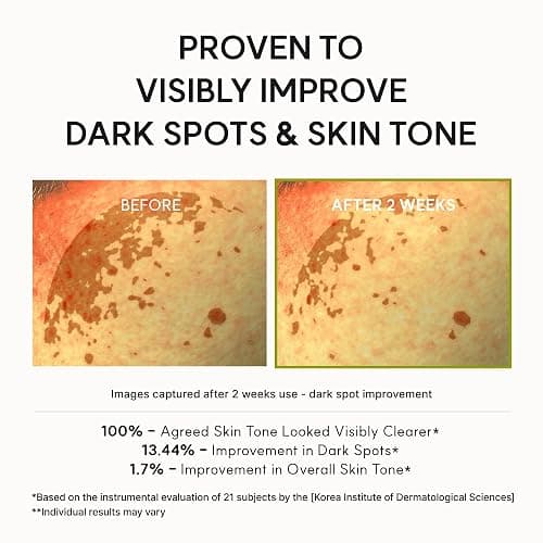 Arencia Vitamin C Booster Shot Serum with Glutathione, Niacinamide and Vitamin E for Dark Spot Care, Fine Lines & Wrinkles, Glass Skin, Korean Skincare 30ml/1.01 fl.oz thumbnail 7
