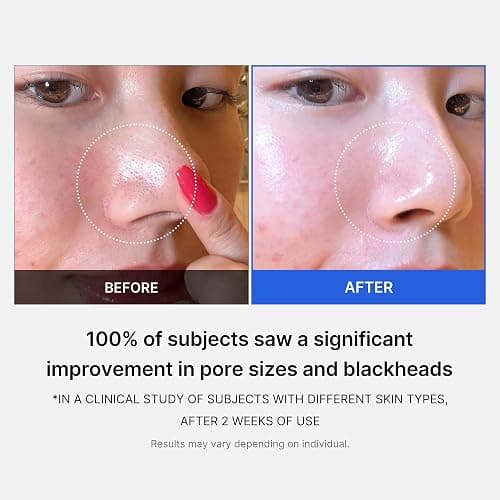 Medicube Zero Pore Pads 2.0, Dual-Textured Facial Toner Pads for Exfoliation and Pore Care with 4.5% AHA Lactic Acid & 0.45% BHA Salicylic Acid, Ideal for All Skin Types, Korean Skin Care (70 Pads) - Zero Pore Pads 2.0, 70 Pads - 70 Count (Pack of 1) thumbnail 4