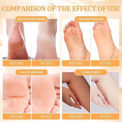 nbc BeautiLab Pedicure Kit Foot Soak Set: Bubble Salt, Sugar Scrub, Massage Mask, Massage Lotion in a Box, 4 Step Foot Spa Kit for Dry Feet,Tired Feet（3 Set Tropical Fruit) thumbnail 3
