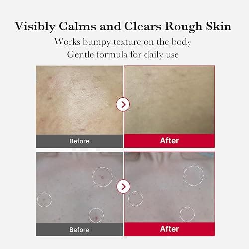 medicube Red Body Peeling Shot, AHA + BHA Exfoliating Body Spray for Summer-Ready Smooth Skin, Treats Strawberry Skin, Bumps & Breakouts, 3.88 oz thumbnail 4