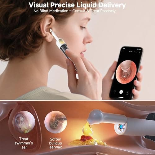 BEBIRD R1 Ultra Ear Wax Removal, Ear Cleaner with Camera Ear Scope, Wax Remove Ear Pick with Ear Otoscope Tweezers, Visual Dropper Cleaning Kit, Ear/Nose/Throat Examination Tool for Family thumbnail 6