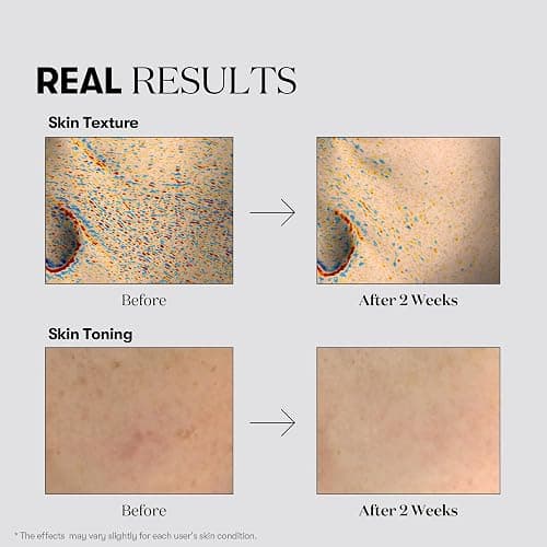 VT COSMETICS TX Toning Daily Mask 30 Sheets, Tranexamic Acid, Niacinamide, Glutathione for Acne Scars, Dark Spots, Sun Spots, Hydrating & Glowing Facial Mask, Fragrance-Free, Korean Face Mask thumbnail 4