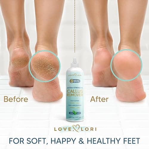 Callus Remover for Feet (Extra Strength) Foot Callus Remover Gel - Pedicure Tools for Feet Scrubber – Foot Care Spa Essentials, 6oz thumbnail 3