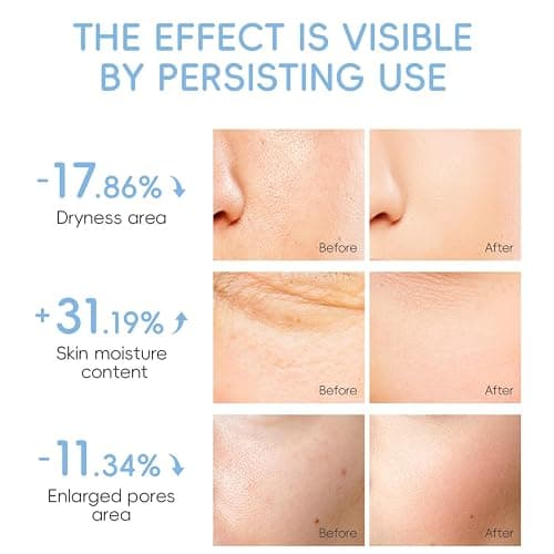 Milk Skin Care Sets & Kits - Milk Beauty Gift Sets for Teenage Girls - Teenage Girls Gifts - Facial Kits for Women - Travel Skincare Set Daily Face Care - Deep Hydrating Smoothing 28PCS (Milk-28PCS) thumbnail 5