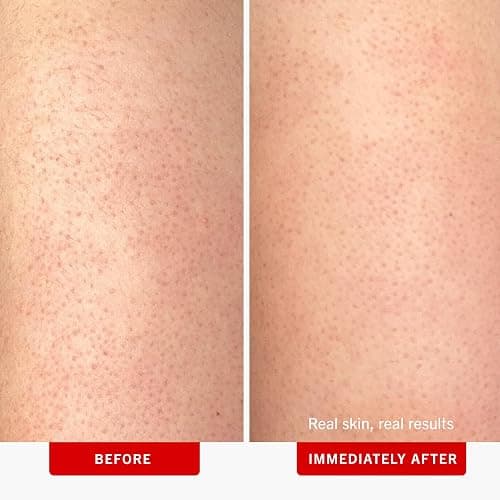 First Aid Beauty KP Bump Eraser Body Scrub with 10% AHA, Keratosis Pilaris Skin Exfoliator with Glycolic and Lactic acids, Helps Reduce Chicken Bumps, Safe for Sensitive Skin, 8 oz thumbnail 3