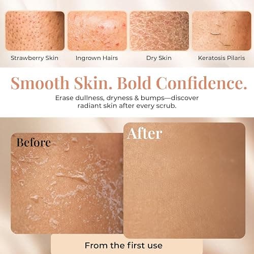 L'Exfose Kessa Hammam Deep Exfoliating Glove 2pc - Korean Exfoliating Mitt for Shower Ideal for Dead Skin Remover, Keratosis Pilaris & Self-Tanning to Improve Skin Tone Made with 100% Natural Viscose thumbnail 5