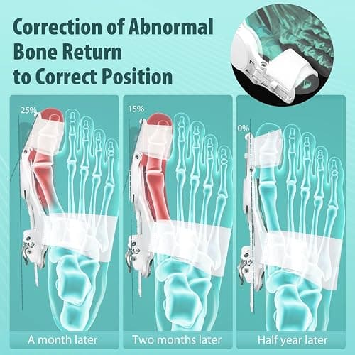 Kutain Comfort Bunion Corrector for Women & Men, Orthopedic Toe Straightener, Adjustable Splint Bunion Pads Day Night Support with Toe Separator for Relief (2PCS) thumbnail 2