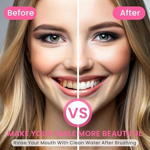 Niacinamide Toothpaste,Niacinamide Intensive Toothpaste,Fresh Breath Toothpastes, Remove Tooth Stains (3.8oz) - 1 thumbnail 5