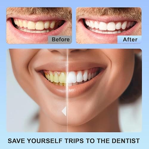 Teeth Whitening Strips 14 Treatments - Whitening Strips Without the Sensitivity - Enamel Safe for Whiter Teeth - Sensitivity Free - 28 Strips (14 Count Pack) O diário de Anne Frank thumbnail 5