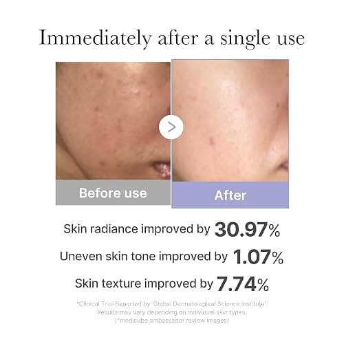 medicube Mini Booster Pro Pink | Affordable At-Home Facial Skin Care Tool for Beginners - Portable Glow Booster for Glass Skin, Boosting Absorption, Korean Skin Care for Teens thumbnail 3