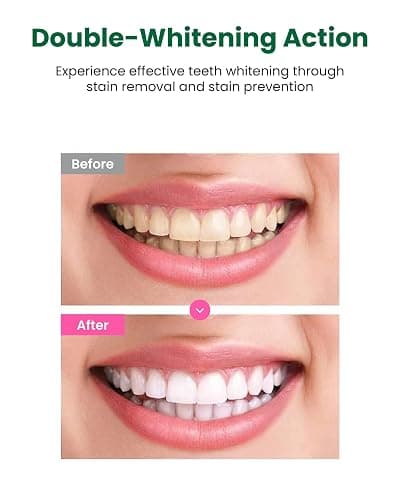 EUTHYMOL Whitening Toothpaste (3.7fl oz) - Stain Removal in 2 Weeks, Long-Lasting Freshness for Sensitive Gum & Teeth. Bad Breath, Cavity Prevention. Recyclable Aluminum Tube thumbnail 4