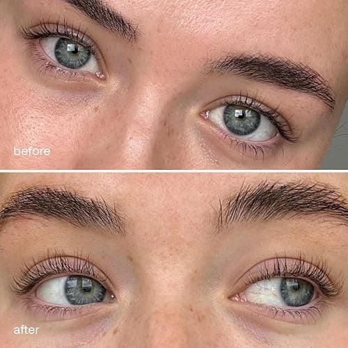 UKLASH Eyelash Complex Serum - #1 Rated Lash Serum for Longer, Stronger Lashes - Cruelty-free, Prostaglandin & Paraben-free - Recommended for All Skin Tones thumbnail 7