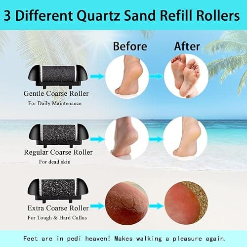 Electric Foot Callus Remover- Long Service Time, Rechargeable Electronic Foot File- Ideal Gift, Professional Pedicure Tools, Waterproof Foot Scrubber, Pedicure Kit Feet Care for Dead Skin (Black) thumbnail 5