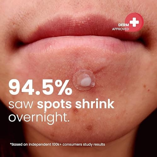 ROSELYNBOUTIQUE Pimple Patches - Hydrocolloid Spot Patches for Blemishes – 300 Clear Dots – Vegan & Cruelty-Free – Cosmetic Facial Skincare Product thumbnail 3
