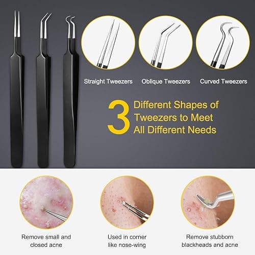 Pimple Popper Tool Kit - Boxoyx 10 Pcs Blackhead Remover Comedone Extractor Kit with Box for Quick and Easy Removal of Pimples, Blackheads, Zit Removing, Forehead,Facial and Nose (Black) thumbnail 4