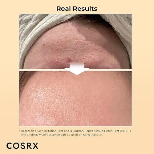 COSRX Snail Mucin Duo - Snail 92 Cream & Snail 96 Essence, Daily Face Gel Moisturizer and Hydrating Serum for Face with Snail Secretion Filtrate, Korean Skin Care thumbnail 5