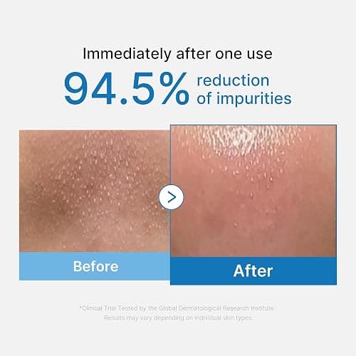 medicube Cleansing Oil Zero Pore Blackhead | Makeup Remover for all skin types, Daily Moisture Facial Cleanser, Low-Irritation, Korean Skin Care, 205ml / 6.93 fl.oz thumbnail 2