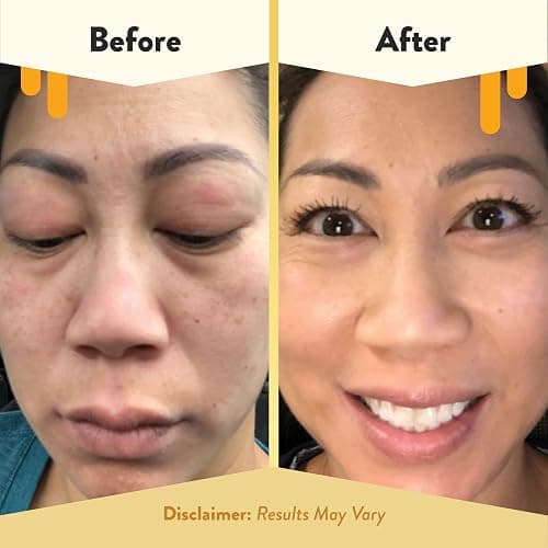 ECZEMA HONEY Soothing Facial Cream - Eczema Lotion for Face, Eyelids, Lips, and More - Natural Dry Skin Repair (2 Oz) thumbnail 4