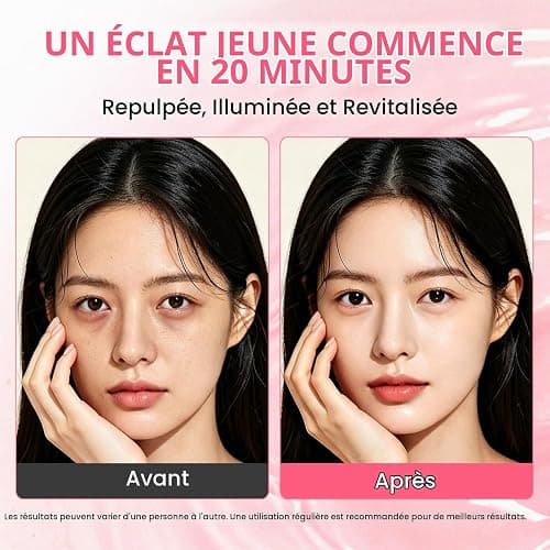 PDRN Collagen Niacinamide Under Eye Patches, Patchs pour les Yeux Hydrogel Pour Cernes, Poches, Antirides et Ridules, Soin Hydratant et Raffermissant Intense, Korean Skincare, 60 Patchs thumbnail 3