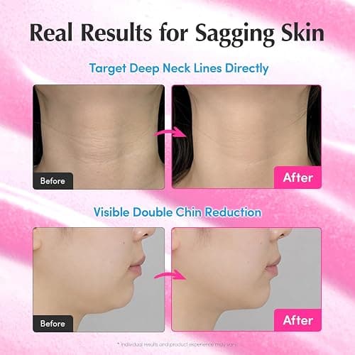 EQQUALBERRY NAD+ Peptide Boosting Serum | 14 Peptide Serum for Face, Neck & Body | Vegan Collagen & Pink Serum for Anti-Aging, Firming & Lifting | Korean Skincare (1.01 oz / 30ml) thumbnail 4