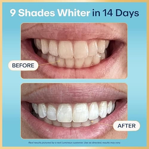 Lumineux Teeth Whitening Strips Kit - 9 Treatments (1 Month) - Peroxide Free - Enamel Safe for Whiter Teeth - Whitening Without The Sensitivity - Dentist Formulated - Sensitivity Free thumbnail 2