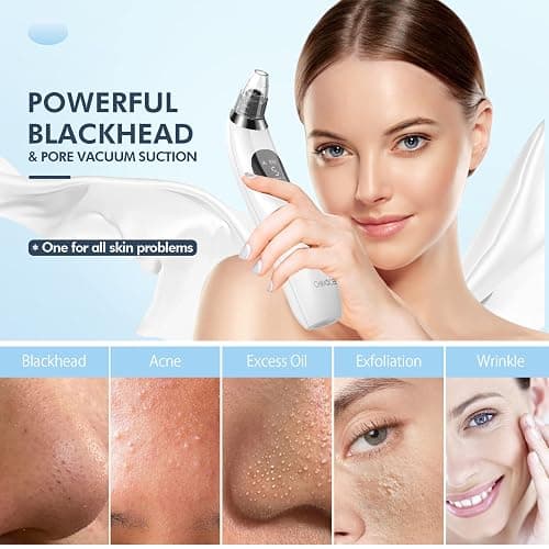 CHIMOCEE Blackhead Remover Pore Vacuum, Upgraded Black Head Remover for Face, Electric Acne Comedone Whitehead Extractor Tools-5 Suction Power, 5 Probes, USB Rechargeable Pimple Popper Tool Kit thumbnail 2