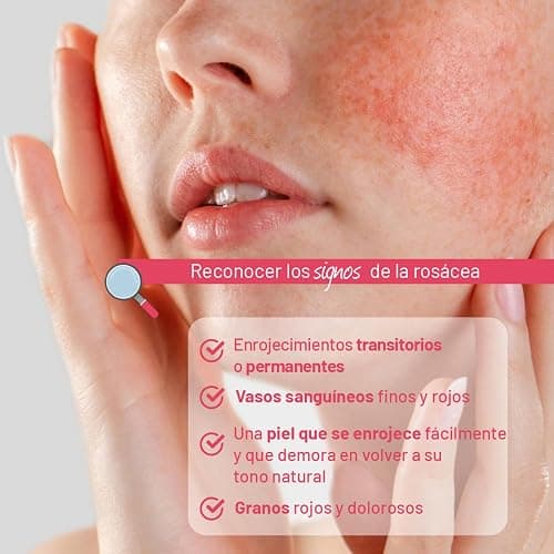 ISISPHARMA METRORUBORIL A.Z Crema - Anti-rojeces 30 ml - Diseñada con un 15% de Ácido Azelaico - Reduce el Enrojecimiento, Mejora la Microcirculación - Productos franceses - 30 ml (Paquete de 1) - blanco thumbnail 6