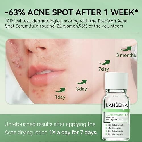 LANBENA Precision Acne Spot Serum, Acne Drying Lotion, Overnight Acne Treatment For Face, Dry Out Pimples, Blemishes, Zits And Clean Pores, 0.42 Fl Oz thumbnail 4