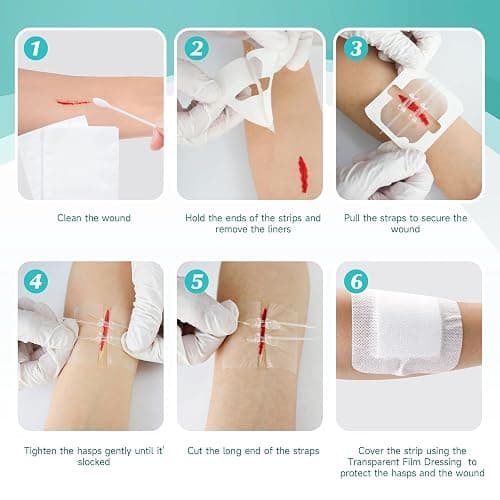 Zip Stitch Wound Closure Kit - 6 Pcs Butterfly Bandages, Surgical Quality, Quick Clot, Suture-Free Surgical Repairment, First Aid Wound Care - Easy Emergency Laceration Closure thumbnail 6