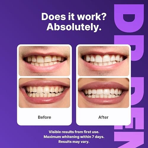 DRDENT Purple Teeth Whitening Strips 21 Treatments - Safe for Enamel - Non Sensitive Teeth Whitening - Whitening Without Any Harm - Pack of 42 thumbnail 3