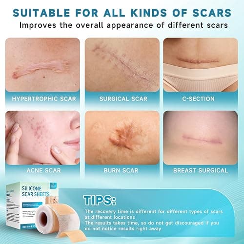 Silicone Scar Sheets, Silicone Scar Tape(1.6”x 60” Roll-1.5M), Silicone Scar Strips, Professional Scar Removal Sheets for Surgical Scars, Keloid, C-Section, Burn et thumbnail 4
