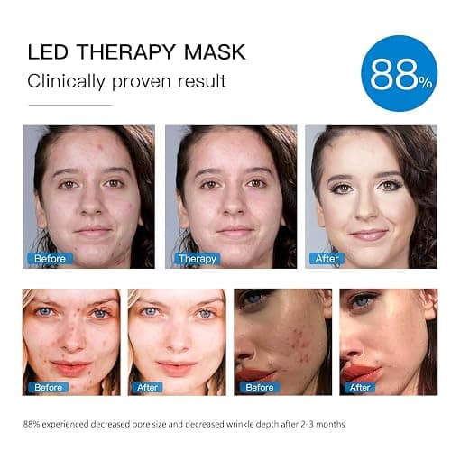 IOBTY Red Light Therapy Mask for Face, Blue & Red LED Light Therapy Face Masks Skincare at Home, USB Rechargeable (Maize Yellow) thumbnail 2