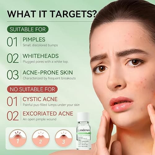 LANBENA Precision Acne Spot Serum, Acne Drying Lotion, Overnight Acne Treatment For Face, Dry Out Pimples, Blemishes, Zits And Clean Pores, 0.42 Fl Oz thumbnail 3