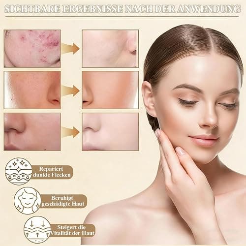 Rice Beauty Mask,Gesichtsmaske Reis & Honig, Nährende Maske Beauty, Reis Clay Mask deckt die Hautpflege ab, zum Reparieren Sie die Hautbarriere,Feuchtigkeitsspendend,Straffende Haut,Für Alle Hauttypen thumbnail 4
