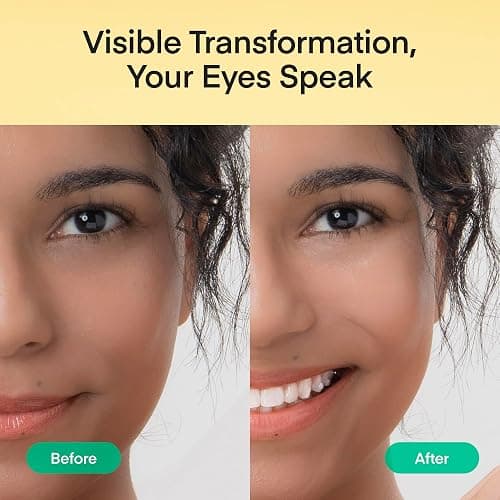 Patchs Yeux Anti-Cernes Korean Skincare: Masque Gel Sous les Yeux à la Vitamine C, Niacinamide, Acide Tranexamique, Caféine & Acide Hyaluronique - Éclat, Anti-Poches & Anti-Rides, 60 Patchs Hydrogel thumbnail 7
