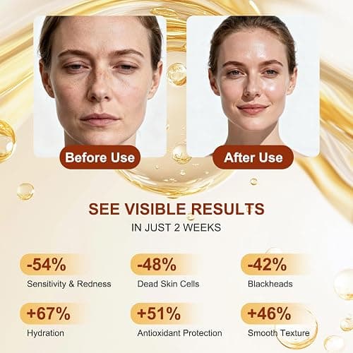 Peel Shot Glow Rice Ampoule Duo – White and Black Rice Exfoliating Ampoules, Pore Minimizing Gentle Peel, Deep Hydration - Christmas Gifts for All Skin thumbnail 4