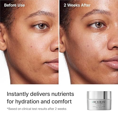 REJURAN® Nutritive Cream, c-PDRN® – Salmon DNA Facial Moisturizer for Nourishing, Deep Hydrating. Achieve Radiant, Youthful Glass Skin. Korean Skincare, Clinically Developed (1.69 fl oz) thumbnail 4
