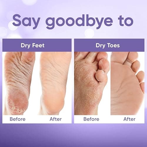 Foot Peel Mask - Foot Mask for Baby Soft Skin - Remove Dead Skin, Dry, Cracked Feet & Callus, Foot Spa, Made with Aloe Vera Extract for Women and Men (2 Pair (Pack of 1), Lavender) thumbnail 5