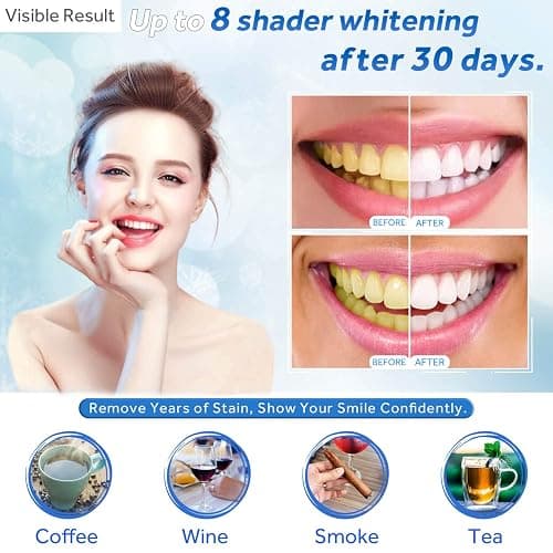 EZGO 10 Pack Teeth Whitening Gel Refills 22% Bleaching Gel, No Sensitive Teeth Whitener, Great for Sensitive Tooth Whitening, Carbamide Peroxide Teeth Whitening Gel, Mint Flavor (10X 3ML) thumbnail 2