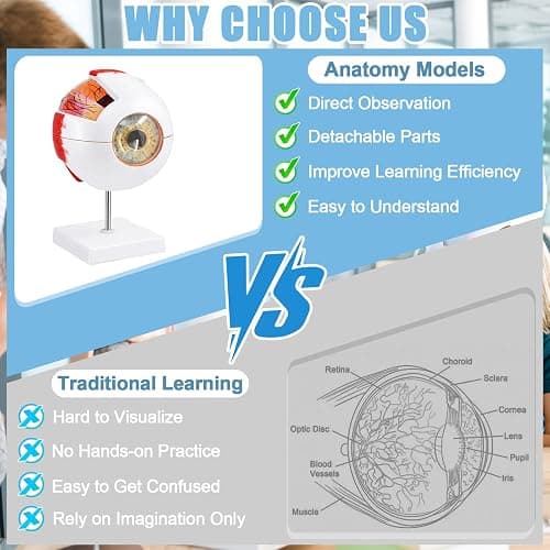Eye Anatomy Model, 6X Enlarged Eyeball Model, Human Eye Anatomical Model for Science Education Students Study Display Medical Teaching, with Removable Stand thumbnail 5