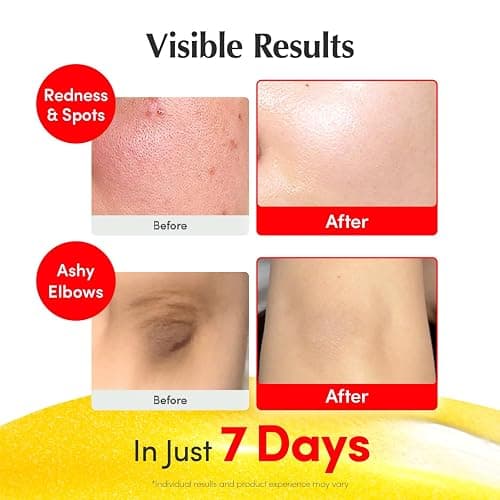 EQQUALBERRY Vitamin Illuminating Serum | Niacinamide 4% + Brightening Vitamin C Face Serum with Hyaluronic Acid & Vitamin E | Dark Spot, Uneven Tone Care | Korean Skincare, 1.01 fl.oz thumbnail 4