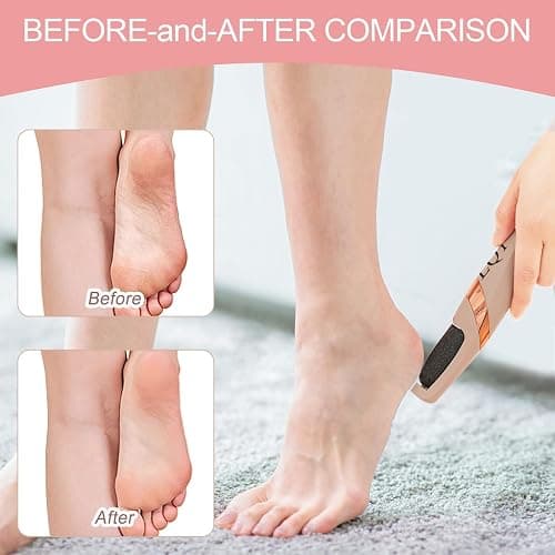 LQT® Electric Foot File – Rechargeable Callus Remover for Hard, Cracked Skin – at-Home Pedicure Kit for Smooth Feet (Men & Women) (Pink) thumbnail 5