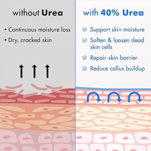 Ebanel Urea Cream 40% plus Salicylic Acid 2%, Foot Cream for Dry Cracked Heels Feet Knees Elbows Hands, Foot Dead Skin Cuticle Callus Remover Toenail Softener, Keratolytic Skin Barrier Repair thumbnail 5