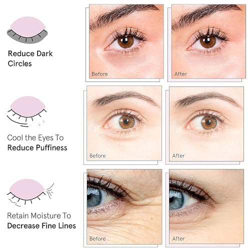 grace & stella Award Winning Under Eye Mask (Blue, 6 Pairs) Reduce Dark Circles, Puffy Eyes, Undereye Bags, Wrinkles, Gel Under Eye Patches, Nurse Gifts, Vegan Cruelty-Free Self Care thumbnail 3