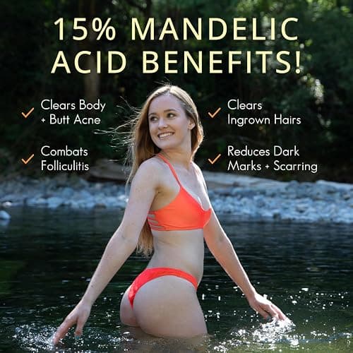 Almond Clear Level 2 Serum | Mandelic Acid Body Serum for Acne, Folliculitis, Aging Skin, Ingrown Hairs, Dark Spots on Face, Chest, Butt, Back, Thighs, Arms | 4 oz thumbnail 4